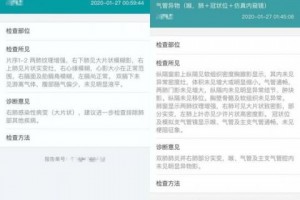 全国肺炎最新消息人数,全国肺炎最新消息人数更新