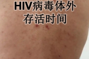 【烟台发现1例无症状感染者/烟台新增1例无症状系境外输入】
