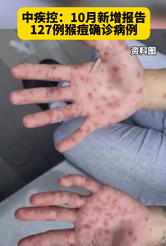 【湖南昨增本土无症状7例/湖南新增1例无症状感染者是哪里的】-第3张图片