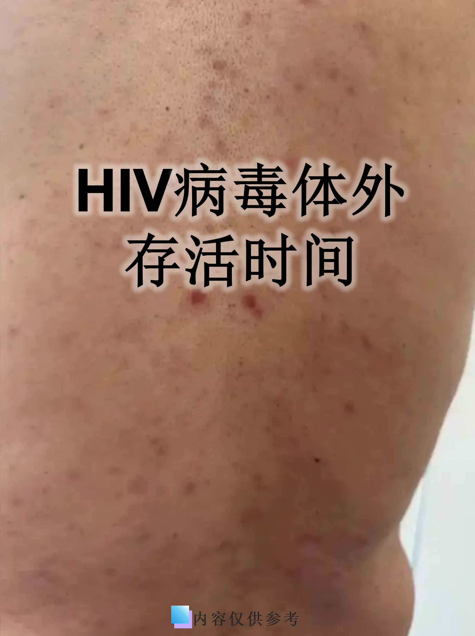【烟台发现1例无症状感染者/烟台新增1例无症状系境外输入】-第1张图片