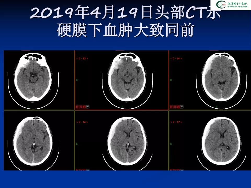 关于沧州新增1例的信息-第2张图片