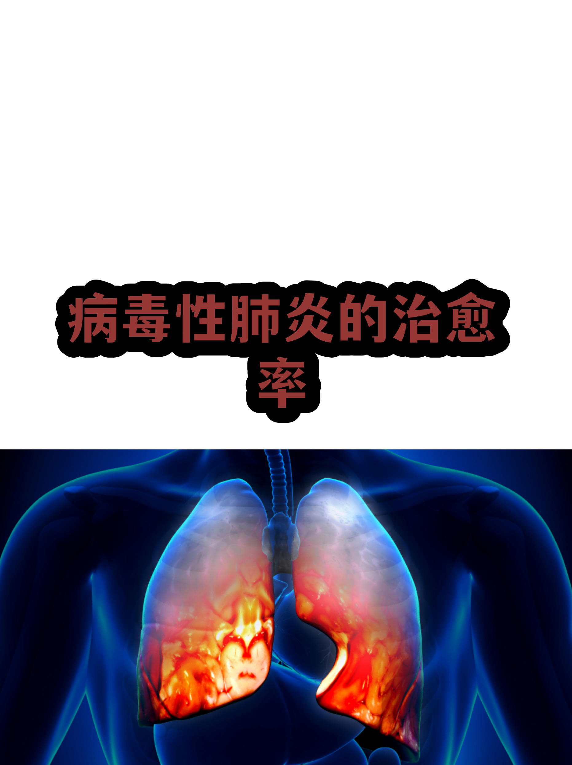多地发现病毒肺炎-疑似病毒性肺炎病例省份-第2张图片