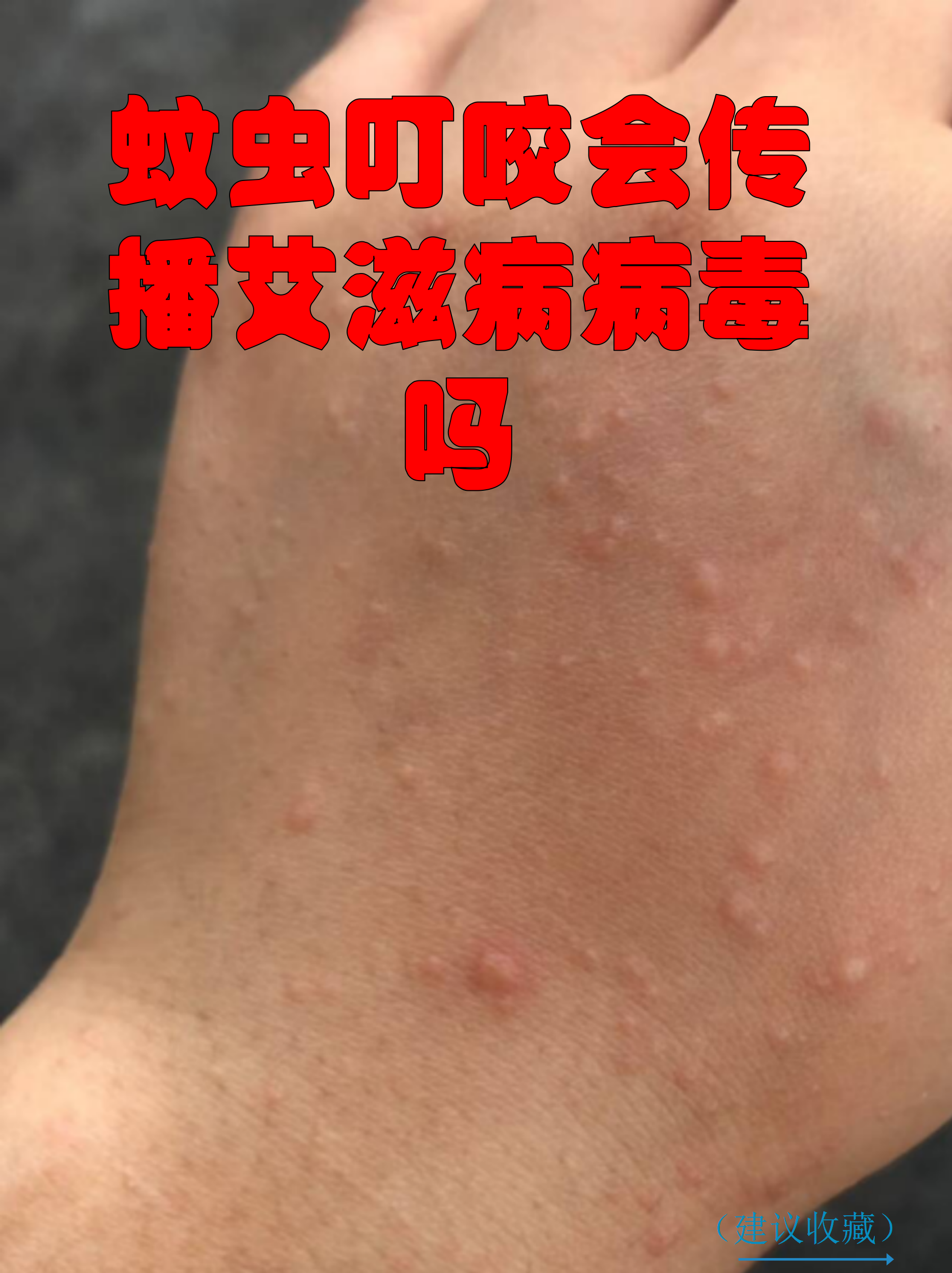 广州发现1例无症状感染者︰(广州新增1例无症状感染)-第2张图片