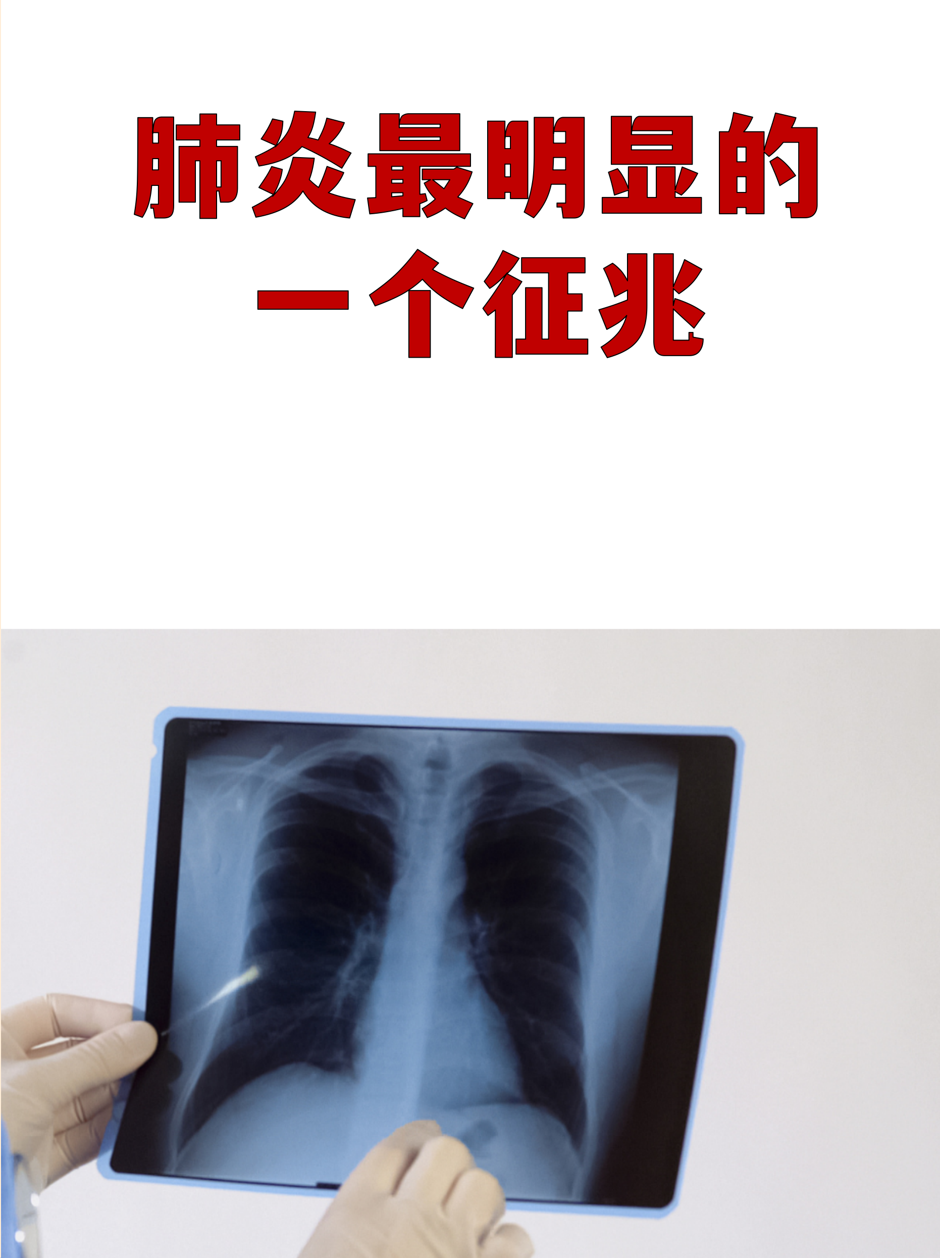 河南新增8例本土确诊〃河南新增8例新型肺炎-第1张图片